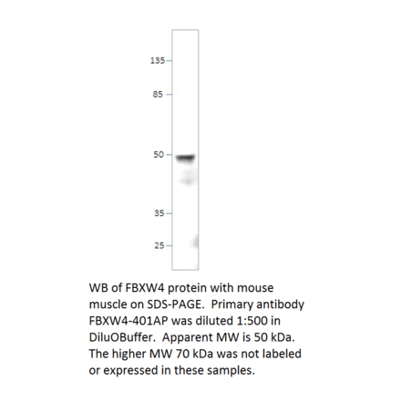 Anti-FBXW4 / SHFM3 Antibody from FabGennix (FBXW4-401AP) - Antibodies.com