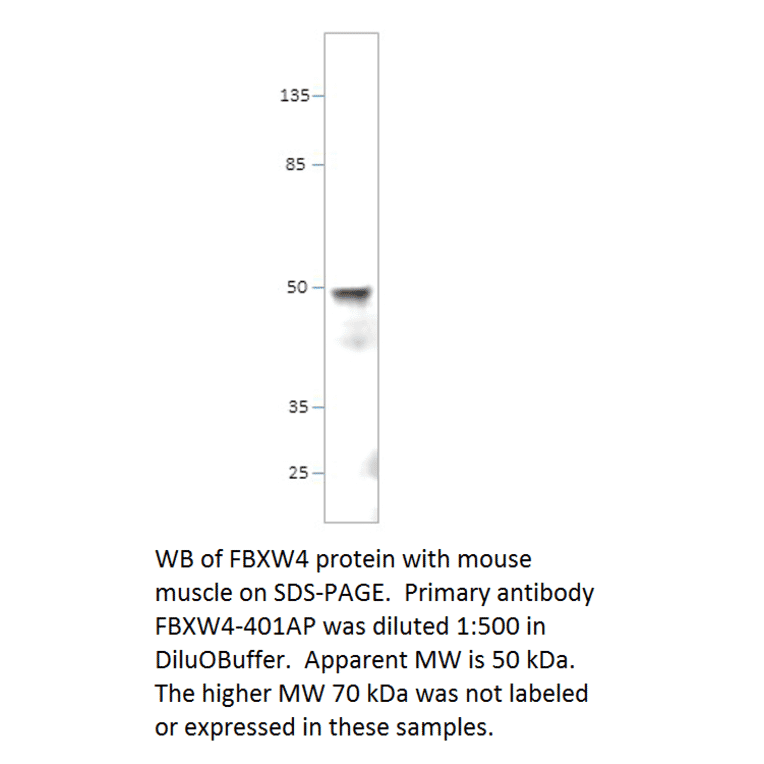 Anti-FBXW4 / SHFM3 Antibody from FabGennix (FBXW4-401AP) - Antibodies.com