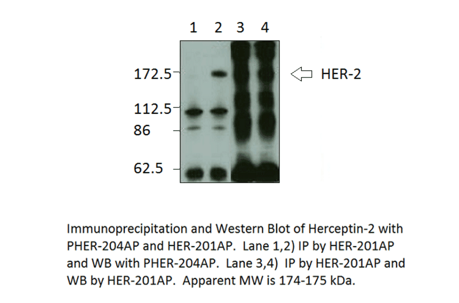 Anti-Phospho-ErbB 2 Antibody from FabGennix (PHER-240AP) - Antibodies.com
