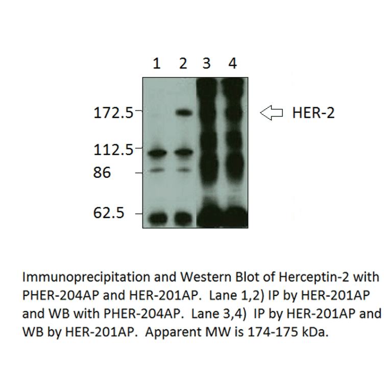 Anti-Phospho-ErbB 2 Antibody from FabGennix (PHER-240AP) - Antibodies.com