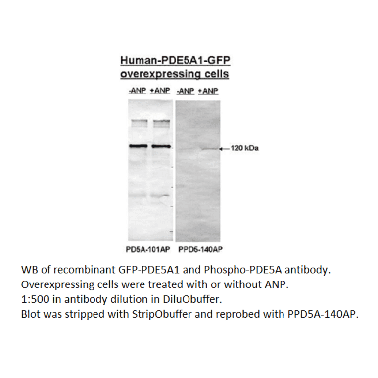 Anti-Phospho-PDE5A Antibody from FabGennix (PPD5A-140AP) - Antibodies.com