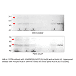 Anti-Phospho-PDE7A Antibody from FabGennix (PPD7A-140AP) - Antibodies.com