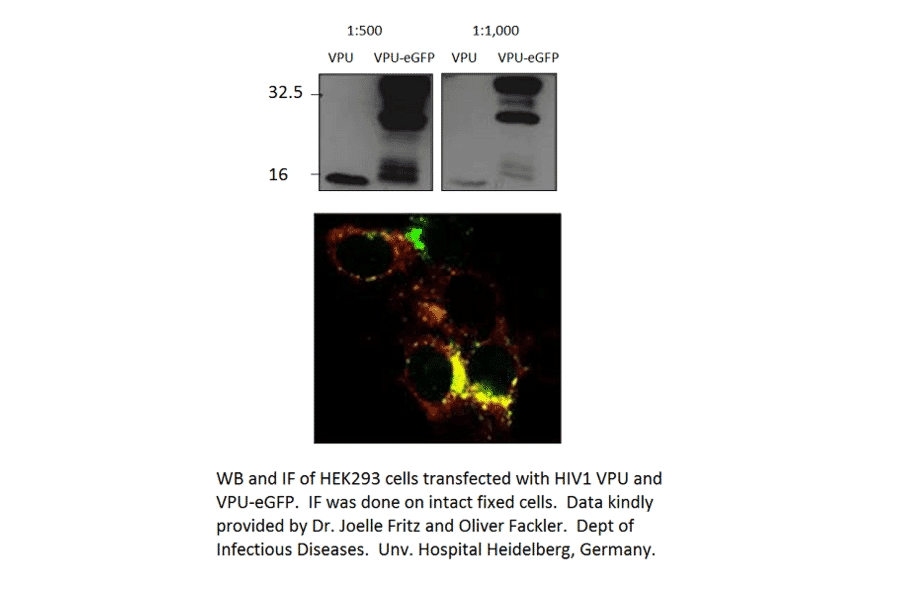 Anti-Viral Protein U Antibody from FabGennix (VPU-101AP) - Antibodies.com