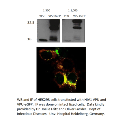 Anti-Viral Protein U Antibody from FabGennix (VPU-101AP) - Antibodies.com