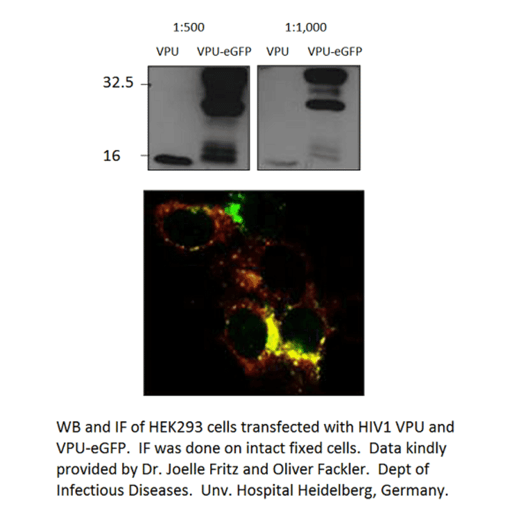 Anti-Viral Protein U Antibody from FabGennix (VPU-101AP) - Antibodies.com
