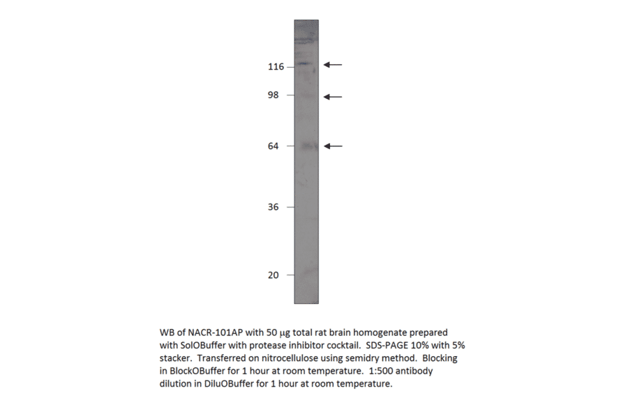 Anti-Nicotinic Acetylcholine Receptor alpha 7 subunit 2 from FabGennix (NACR-101AP) - Antibodies.com