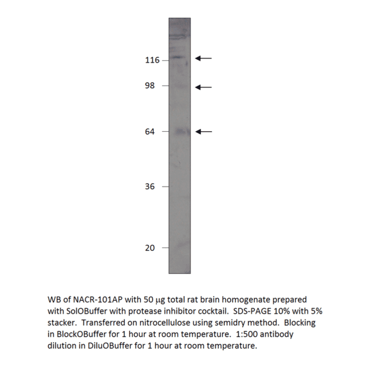 Anti-Nicotinic Acetylcholine Receptor alpha 7 subunit 2 from FabGennix (NACR-101AP) - Antibodies.com