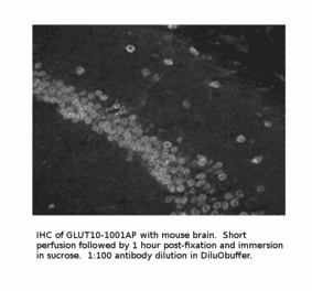 Anti-Glucose Transporter GLUT10 Antibody from FabGennix (GLUT10-1001AP) - Antibodies.com