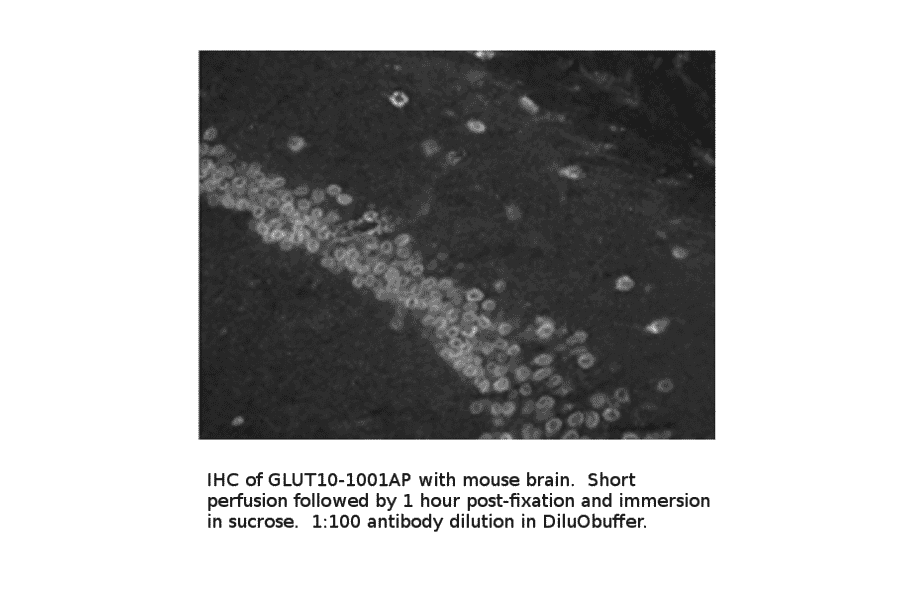 Anti-Glucose Transporter GLUT10 Antibody from FabGennix (GLUT10-1001AP) - Antibodies.com