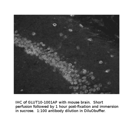 Anti-Glucose Transporter GLUT10 Antibody from FabGennix (GLUT10-1001AP) - Antibodies.com