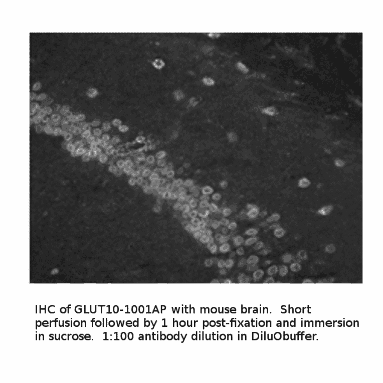 Anti-Glucose Transporter GLUT10 Antibody from FabGennix (GLUT10-1001AP) - Antibodies.com