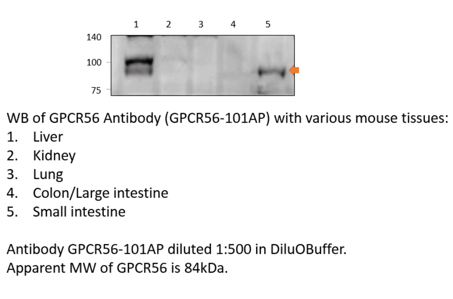 Anti-GPR56 Extracellular domain Antibody from FabGennix (GPCR56-101AP) - Antibodies.com