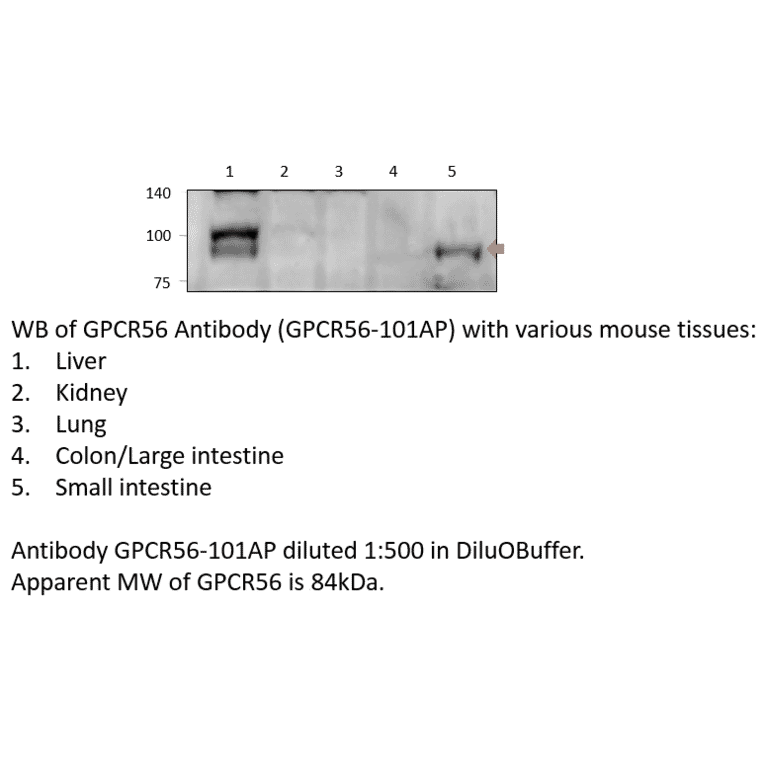 Anti-GPR56 Extracellular domain Antibody from FabGennix (GPCR56-101AP) - Antibodies.com