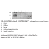 Anti-GPR56 Extracellular domain Antibody from FabGennix (GPCR56-101AP) - Antibodies.com