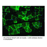 Anti-Glucose Transporter GLUT 4 Antibody from FabGennix (GLUT4-401AP) - Antibodies.com