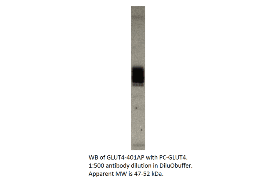 Anti-Glucose Transporter GLUT 4 Antibody from FabGennix (GLUT4-401AP) - Antibodies.com