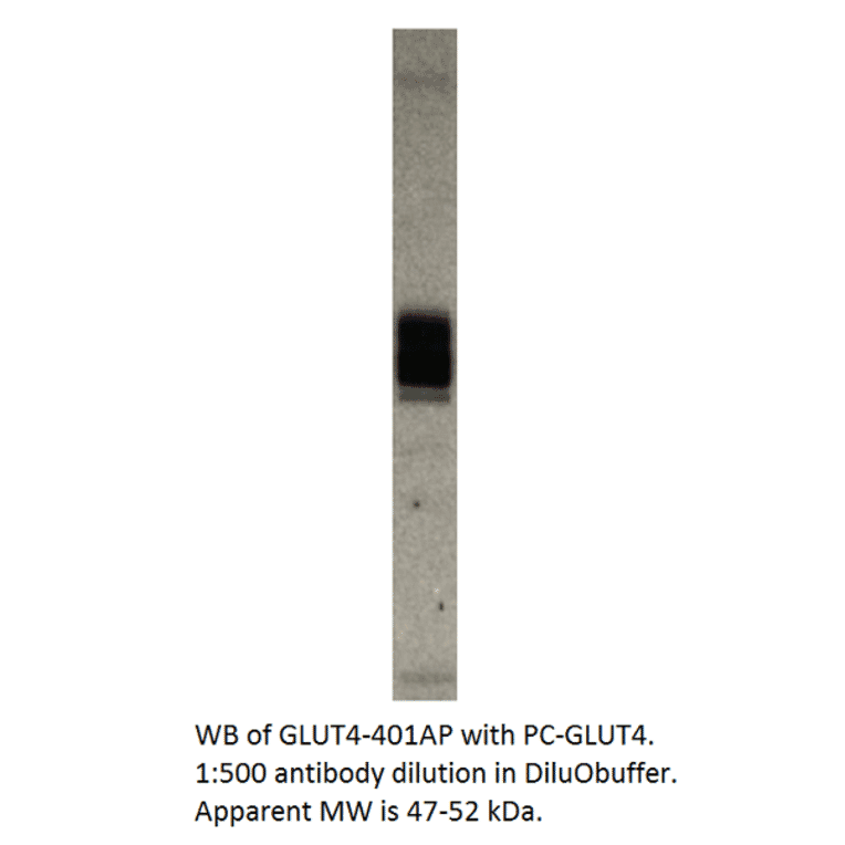 Anti-Glucose Transporter GLUT 4 Antibody from FabGennix (GLUT4-401AP) - Antibodies.com