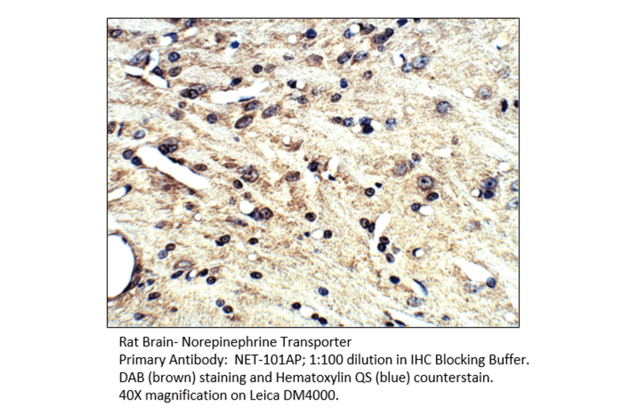 Anti-Norepinephrine Transporter Antibody from FabGennix (NET-101AP) - Antibodies.com