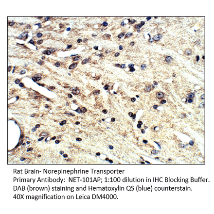 Anti-Norepinephrine Transporter Antibody from FabGennix (NET-101AP) - Antibodies.com