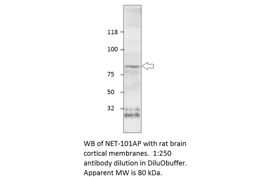 Anti-Norepinephrine Transporter Antibody from FabGennix (NET-101AP) - Antibodies.com