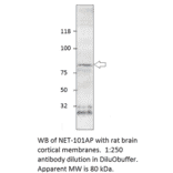 Anti-Norepinephrine Transporter Antibody from FabGennix (NET-101AP) - Antibodies.com