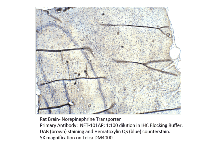 Anti-Norepinephrine Transporter Antibody from FabGennix (NET-101AP) - Antibodies.com