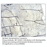 Anti-Norepinephrine Transporter Antibody from FabGennix (NET-101AP) - Antibodies.com