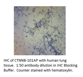 Anti-beta Catenin Antibody (A53714) - Antibodies.com
