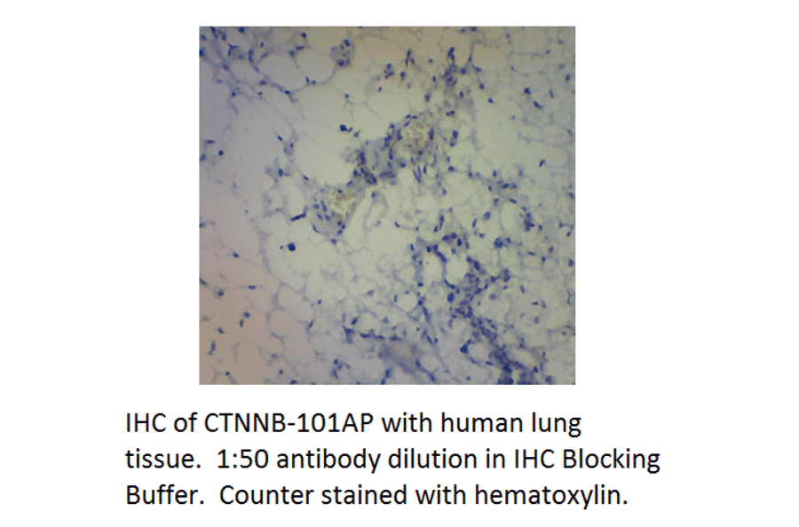 Anti-beta Catenin Antibody from FabGennix (CTNNB-101AP) - Antibodies.com