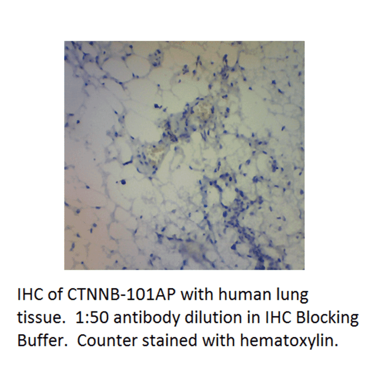 Anti-beta Catenin Antibody from FabGennix (CTNNB-101AP) - Antibodies.com