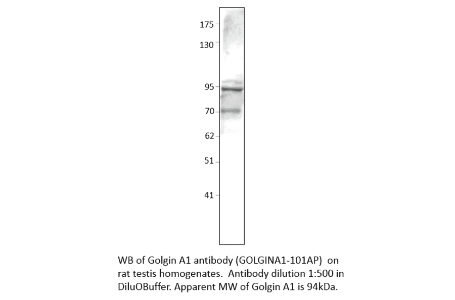 Anti-Golgin A1 Antibody from FabGennix (GOLGINA1-101AP) - Antibodies.com