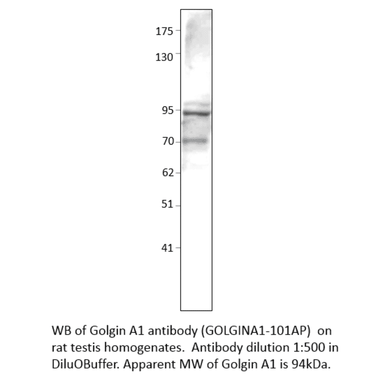 Anti-Golgin A1 Antibody from FabGennix (GOLGINA1-101AP) - Antibodies.com