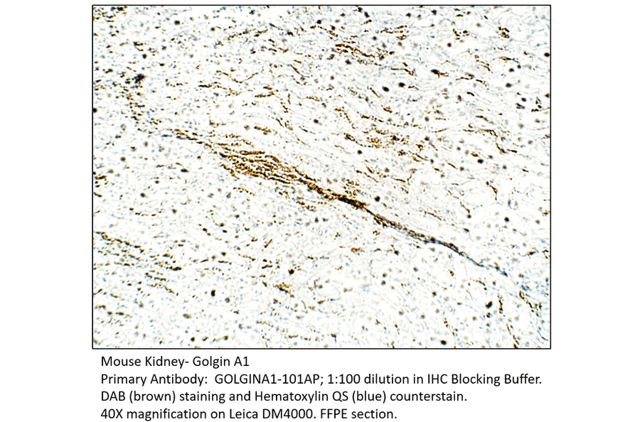 Anti-Golgin A1 Antibody from FabGennix (GOLGINA1-101AP) - Antibodies.com