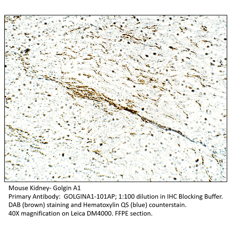Anti-Golgin A1 Antibody from FabGennix (GOLGINA1-101AP) - Antibodies.com