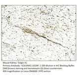 Anti-Golgin A1 Antibody from FabGennix (GOLGINA1-101AP) - Antibodies.com