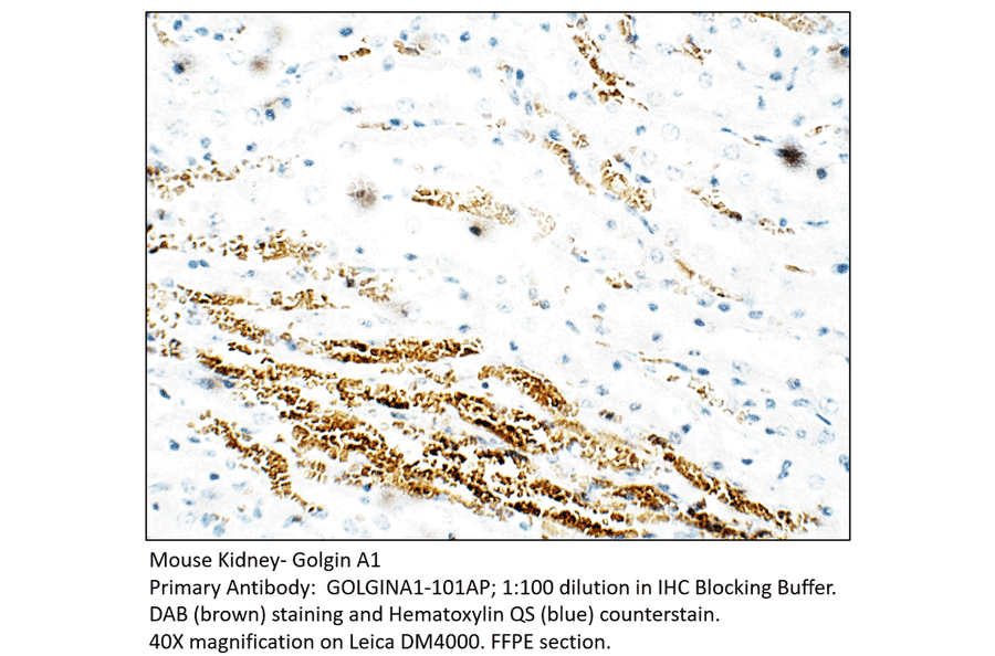 Anti-Golgin A1 Antibody from FabGennix (GOLGINA1-101AP) - Antibodies.com
