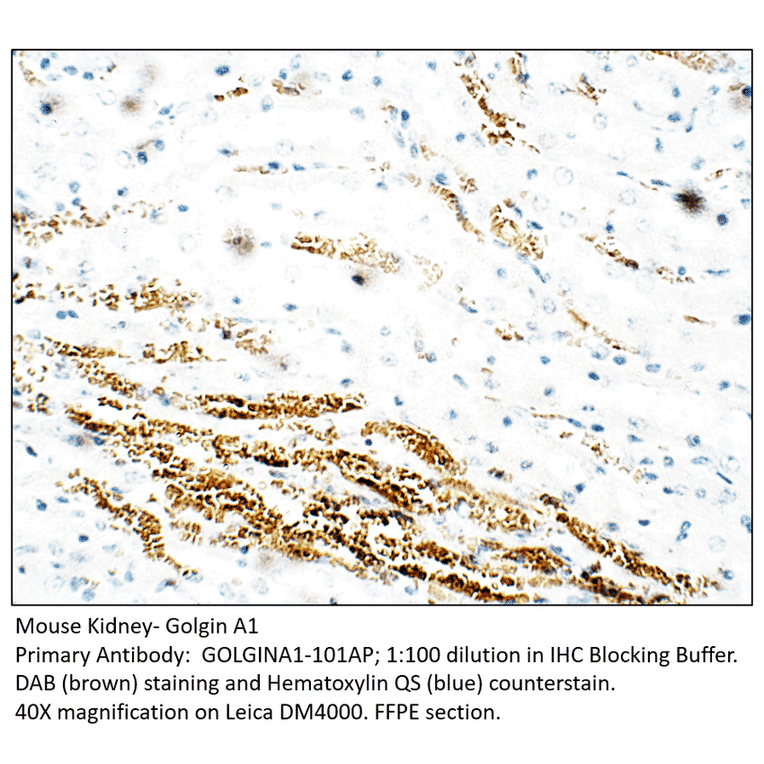 Anti-Golgin A1 Antibody from FabGennix (GOLGINA1-101AP) - Antibodies.com