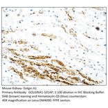 Anti-Golgin A1 Antibody from FabGennix (GOLGINA1-101AP) - Antibodies.com