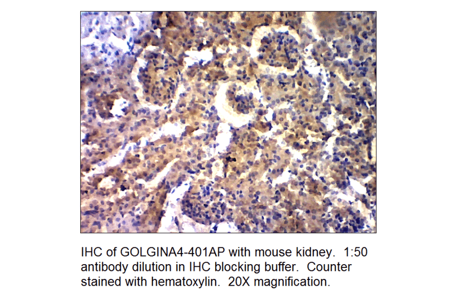 Anti-Golgin A4 Antibody from FabGennix (GOLGINA4-401AP) - Antibodies.com