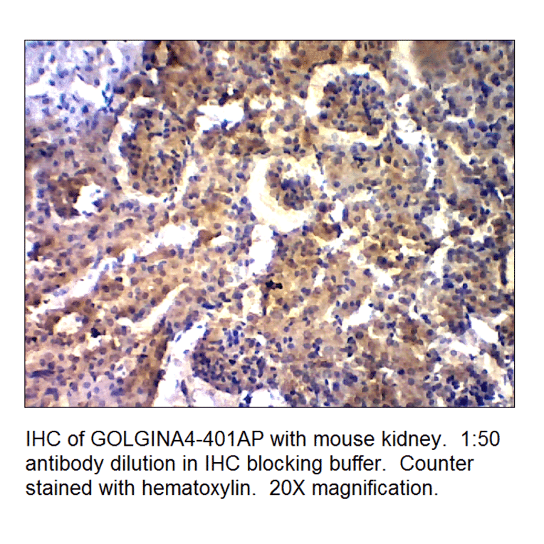 Anti-Golgin A4 Antibody from FabGennix (GOLGINA4-401AP) - Antibodies.com
