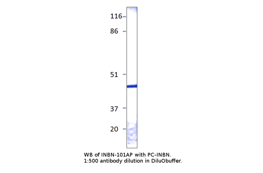 Anti-Inhibin alpha Antibody from FabGennix (INBN-101AP) - Antibodies.com