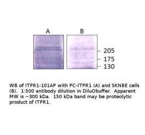 Anti-IP3 receptor Antibody from FabGennix (ITPR1-101AP) - Antibodies.com