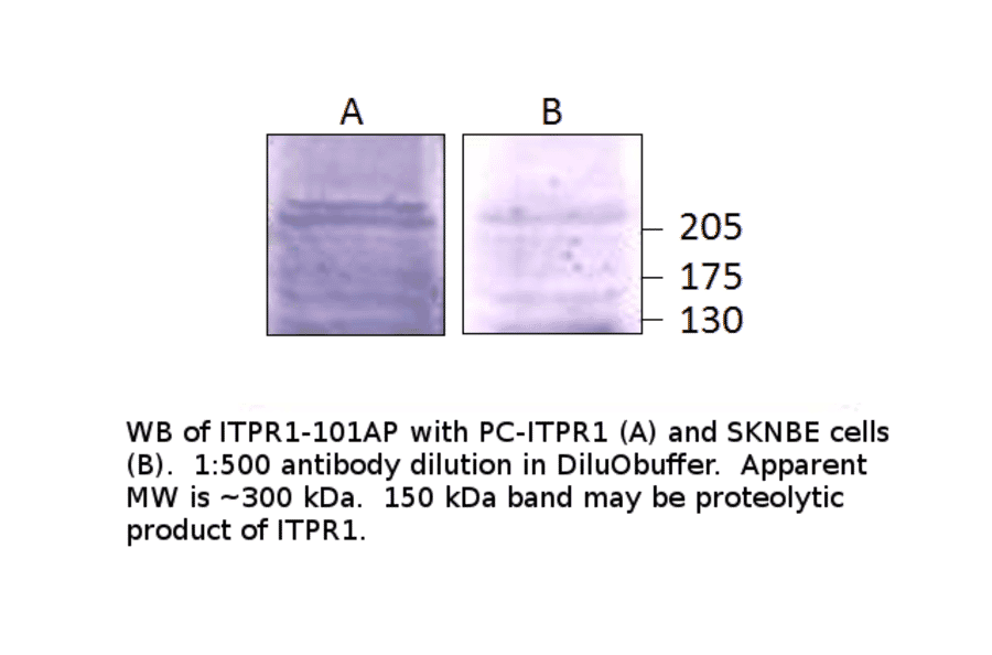 Anti-IP3 receptor Antibody from FabGennix (ITPR1-101AP) - Antibodies.com