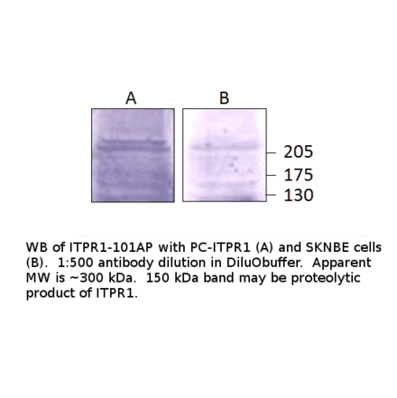 Anti-IP3 receptor Antibody from FabGennix (ITPR1-101AP) - Antibodies.com