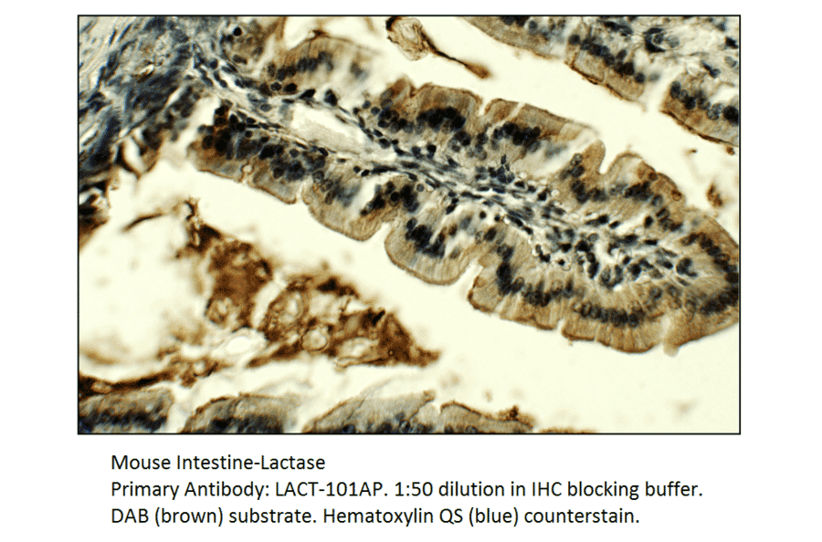 Anti-Lactase (LCT) Antibody from FabGennix (LACT-101AP) - Antibodies.com