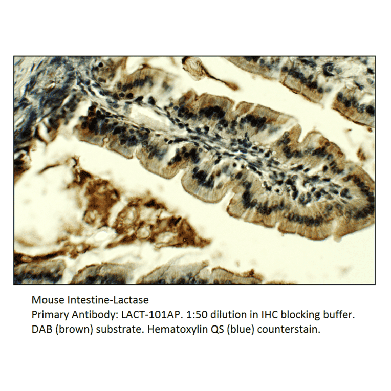 Anti-Lactase (LCT) Antibody from FabGennix (LACT-101AP) - Antibodies.com