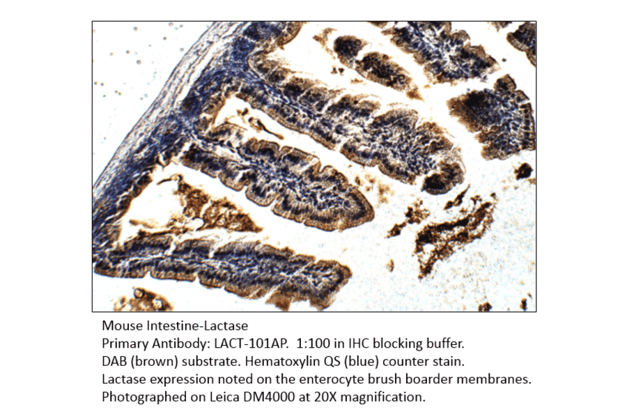 Anti-Lactase (LCT) Antibody from FabGennix (LACT-101AP) - Antibodies.com