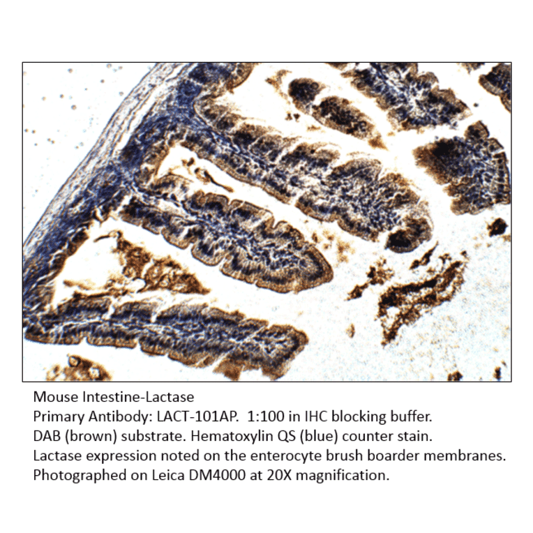Anti-Lactase (LCT) Antibody from FabGennix (LACT-101AP) - Antibodies.com