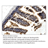 Anti-Lactase (LCT) Antibody from FabGennix (LACT-101AP) - Antibodies.com