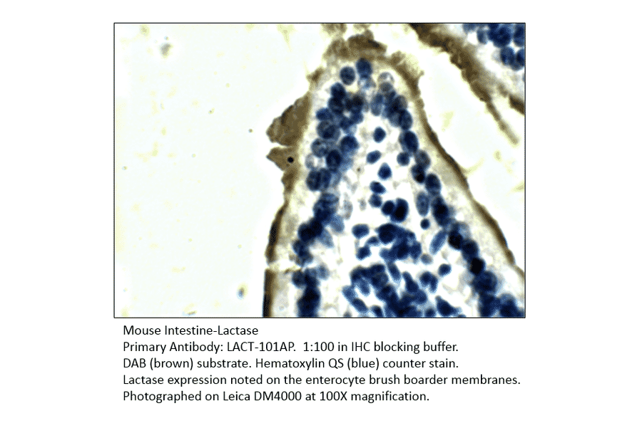 Anti-Lactase (LCT) Antibody from FabGennix (LACT-101AP) - Antibodies.com